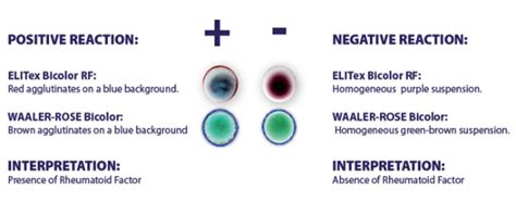 Rheumatoid Factor Test