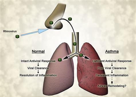 Rhinovirus and asthma
