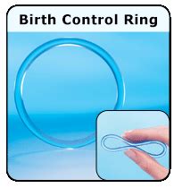 ring birth control