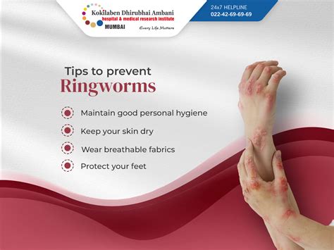 Ringworm Prevention