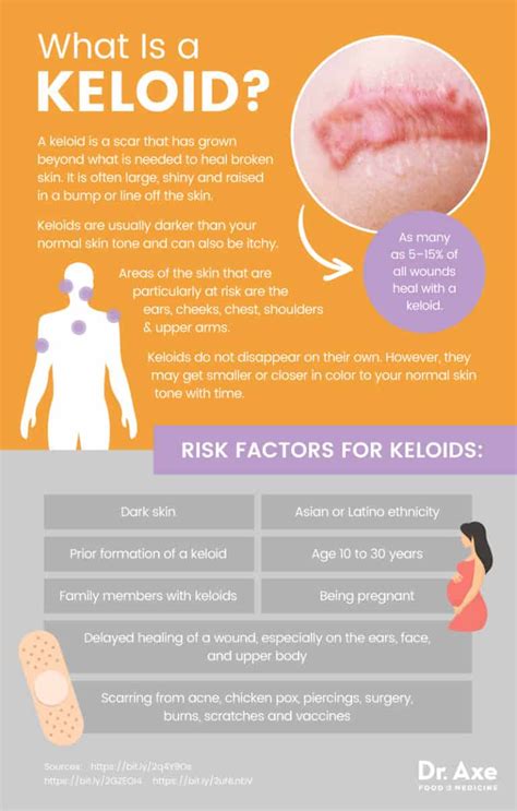 Risk Factors for Keloid Scars
