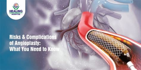 Risks and Complications of Angioplasty