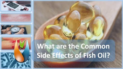 Potential Risks and Side Effects of Fish Oil Supplementation
