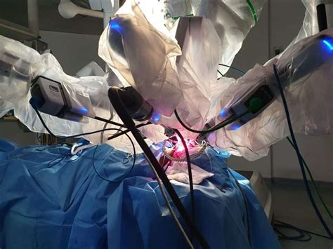 Robotic thyroidectomy