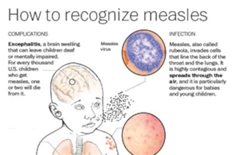 roseola vaccination