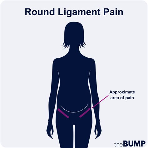 round ligament pain