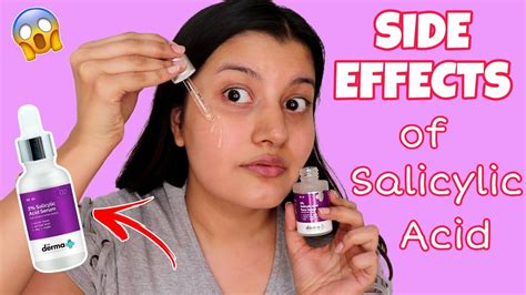 Salicylic Acid Cream Side Effects