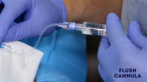 saline flush techniques