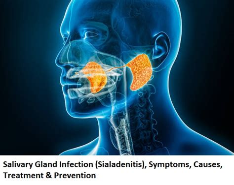 salivary gland prevention