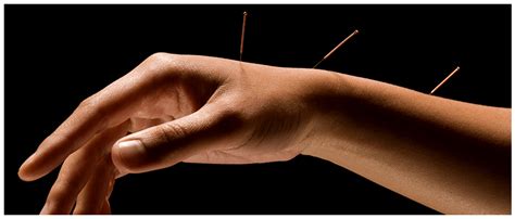 science behind acupuncture