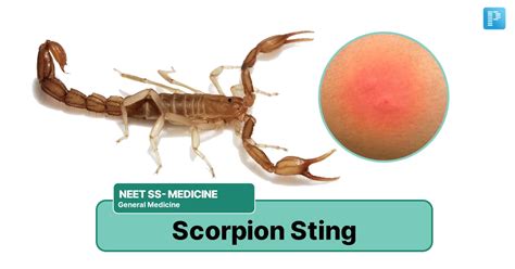 scorpion prevention and treatment