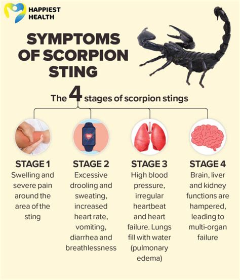 scorpion sting treatment
