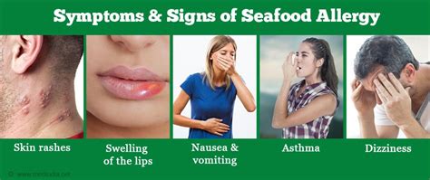 Diagnosis of Mild Seafood Allergy Symptoms