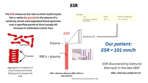 Sed rate conclusion
