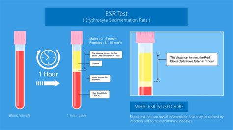 Sed Rate Conclusion