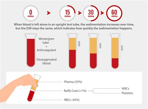 Conditions Diagnosed with Sed Rate