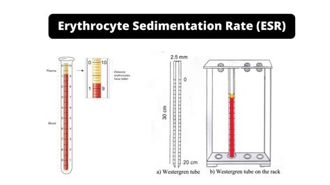 sedimentation rate future