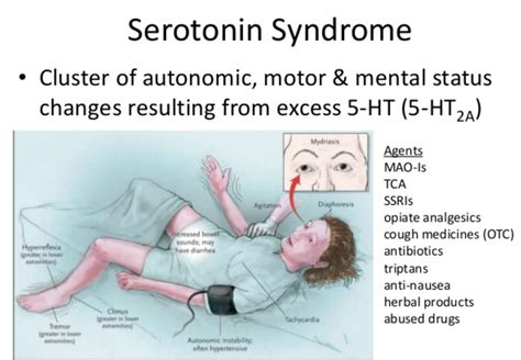 Serotonin Syndrome Causes