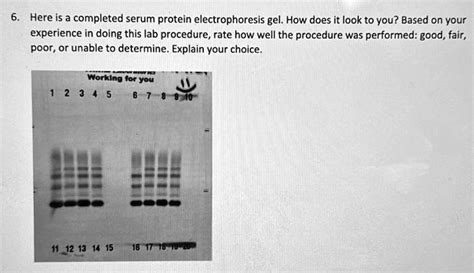 Serum Proteins
