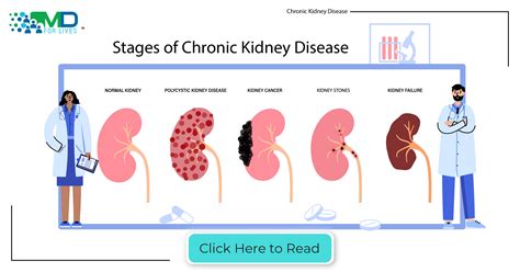Severe Kidney Damage