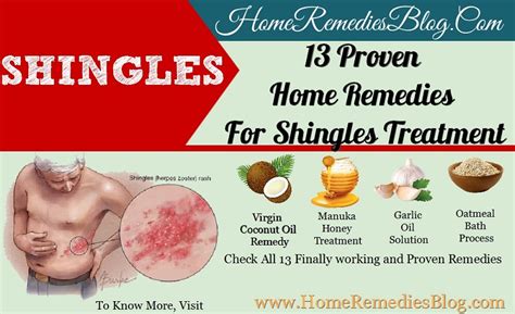 Shingles Relief