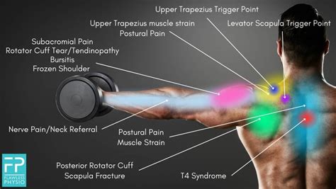 shoulder pain