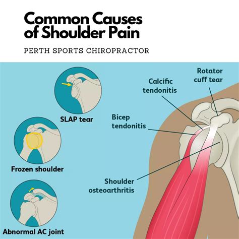 Shoulder Tip Area