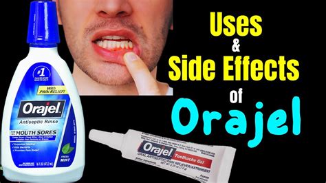 Benzocaine side effects