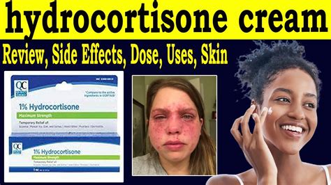 side effects of hydrocortisone cream