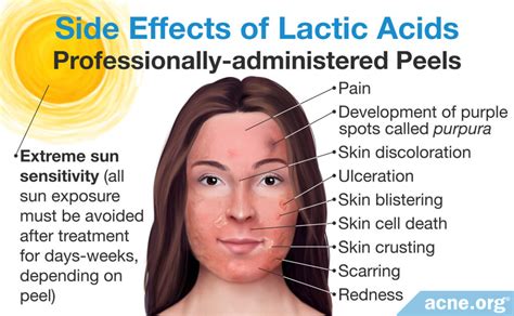 side effects of lactic acid