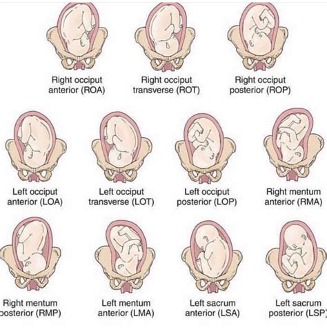 Significance of Baby Positions