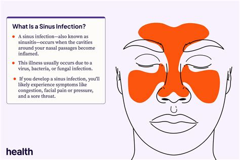 sinus infections