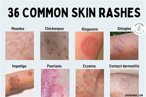 skin allergy awareness