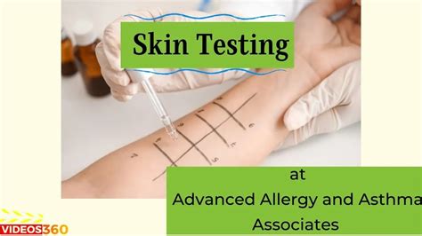 skin allergy test