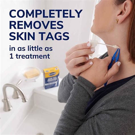 Skin tag removal methods