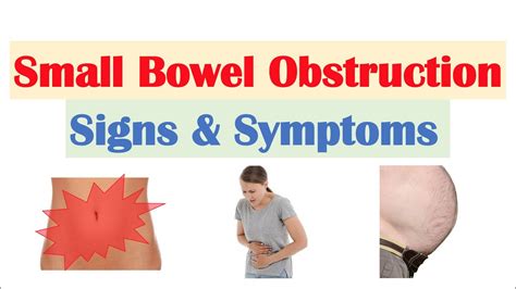 Abdominal pain illustration