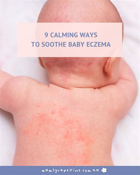 soothe infant face rash