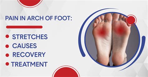sore feet arch