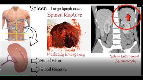 spleen image