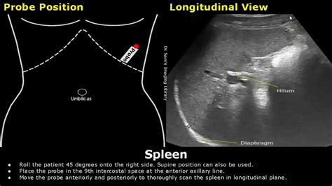 spleen functions