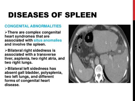 spleen disorders