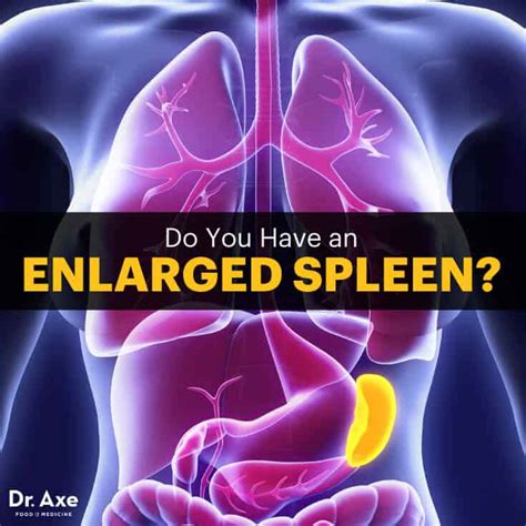 spleen issues