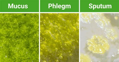 Sputum vs phlegm difference