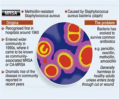 Staph Infection Research