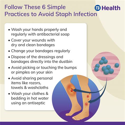 Staph Infection Treatment