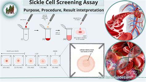 steps to take after receiving sickle cell test results