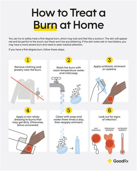 Steps to Treat Burns at Home
