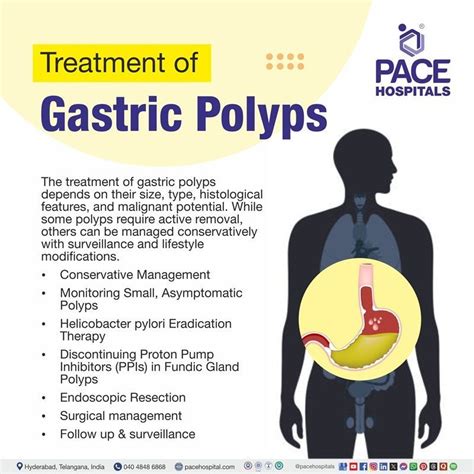 Stomach Polyps Treatment