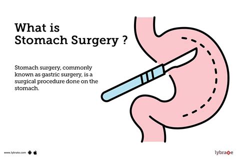 Stomach Surgery