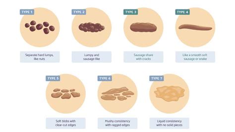 stool conditions